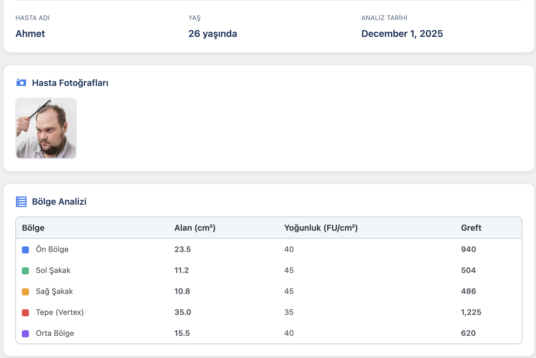 Novera Graft Analyzer Bölge Analizi